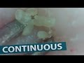 #22 Continuous Removal of Blackheads Close up - Squeezing Blackheads