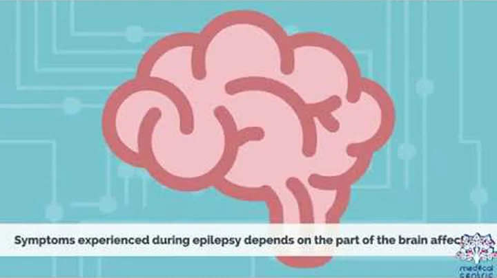 EPILEPSY, Causes, Signs and Symptoms, Diagnosis and Treatment. - DayDayNews