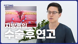 지방흡입 수술 후 연고 추천 및 올바른 사용법