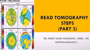 How to read corneal tomography printout || Pentacam