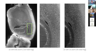 A Practical Guide to Mapping Brain Activity with ClearMap2