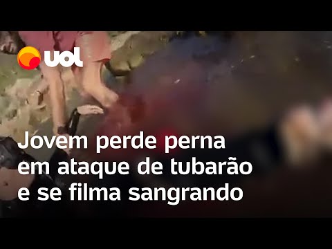 Jovem perde perna em ataque de tubarão e se filma sangrando: 'Me despedir'