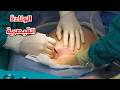 شاهد الولادة القيصرية والولادة االطبيعيةوحدد ايهما افضل Watch Caesarean Section And Natural Birth