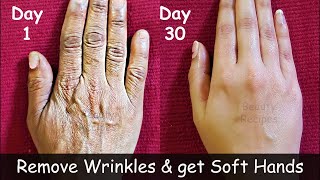Say Goodbye to Wrinkled Hands: Easy Methods to Remove Wrinkles
