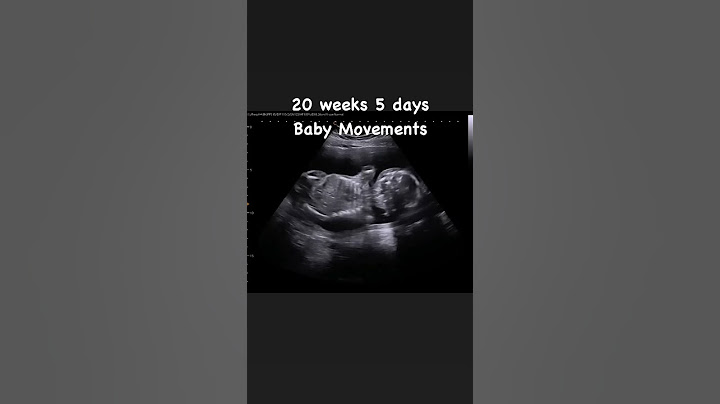 20 weeks 5 days Baby Movements 🥰 #jerbearimaging #athome #ultrasound #babymovement #babylife #sono