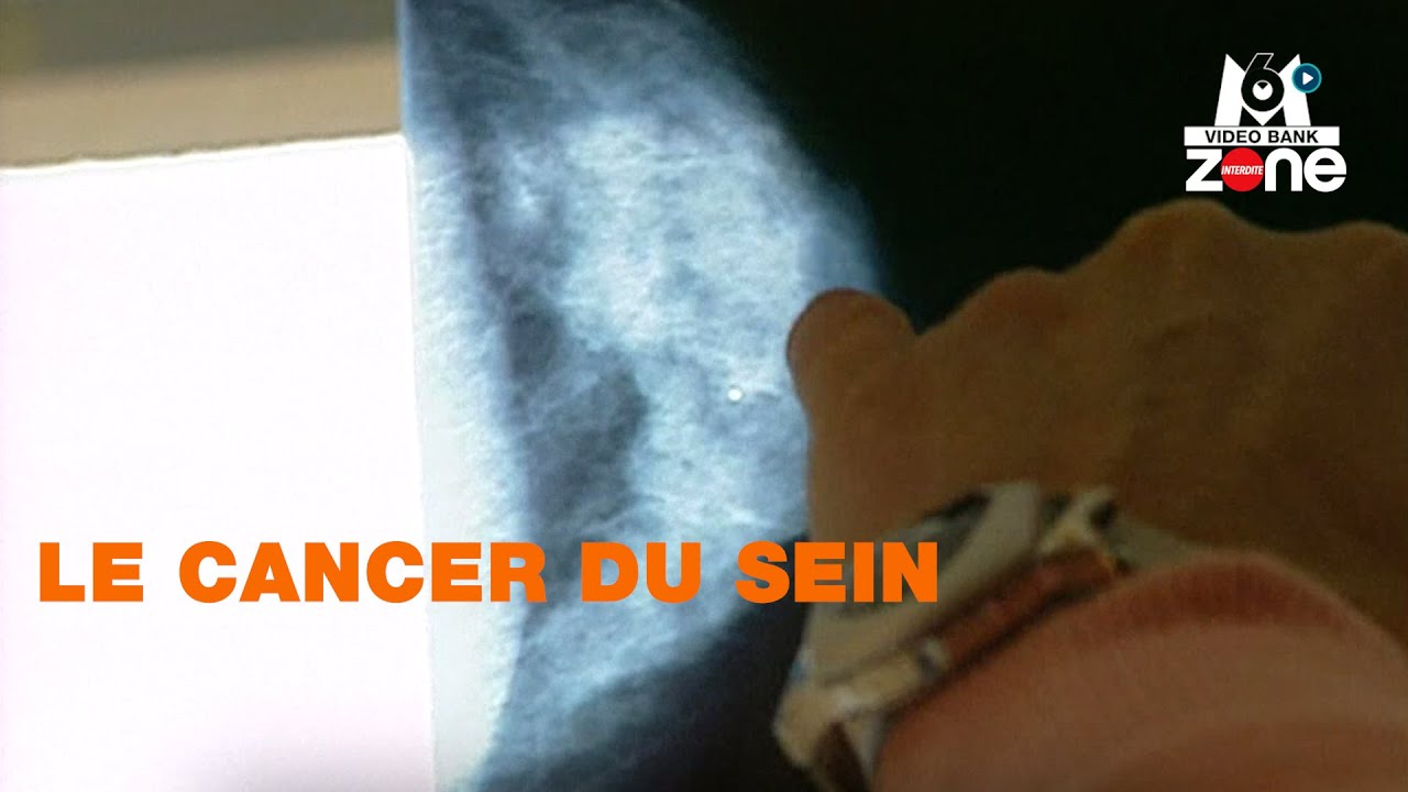 Dépister le cancer du sein peut sauver la vie // Extrait archives M6 Video Bank