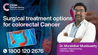 Play video: What are the Surgical treatment options for colorectal Cancer ?