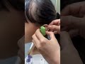 Girl Gets a Custom Hearing Aid! 👂💚This little girl was having trouble hearing, so 🩺✨