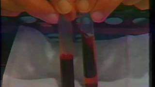 Laboratory Aids In Diagnosis - Part II