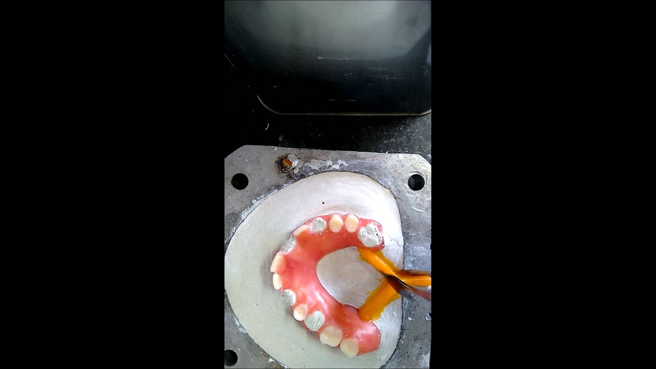 Inclusão de prótese flexível