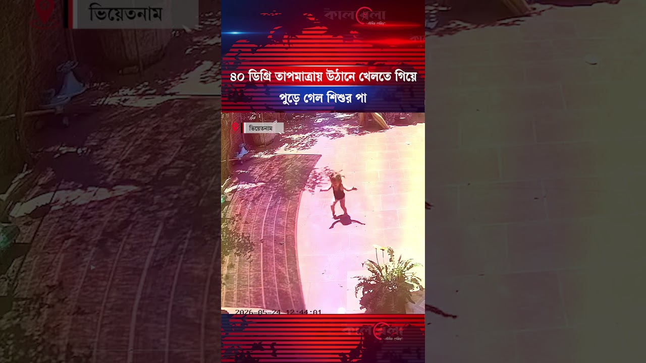 রোদের তাপে উত্তপ্ত উঠান, খেলতে গিয়েই পা পু'ড়'ল শি'শু'র