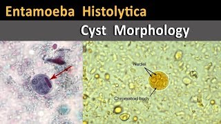 Entamoeba Histolytica Cyst Morphology Entamoeba Histolytica Cyst Morphology