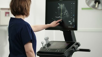Sonosite LX Performing an Exam