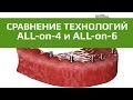 Имплантация с немедленной нагрузкой протезом. Отличие технологии All-on-4 от All-on-6