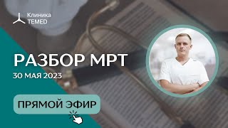 Разбор МРТ (30.05.23)