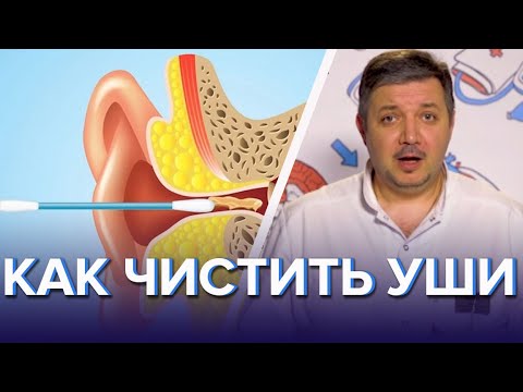 Как правильно чистить уши - Доктор 24