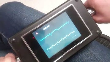 Hand ECG using Arduino and TV