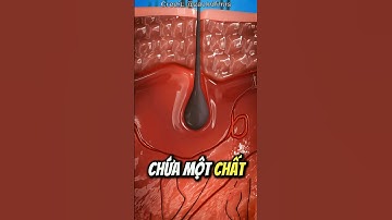 Vì Sao Bạn Nổi Mụn 😱 (Mụn Trứng Cá)