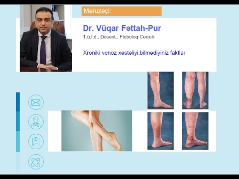 Video: Perivaskulyar dermatiti necə müalicə etmək olar?