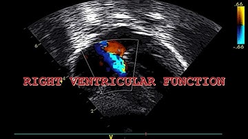 ECHOCARDIOGRAPIC EVALUATION OF HEMODYNAMICS IN NEONATES (PART 4/5). RIGHT VENTRICULAR FUNCTION
