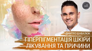 Гіперпігментація шкіри. Причини виникнення