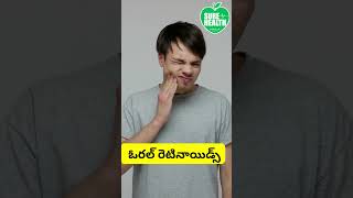 సోరియాసిస్ చికిత్స ఎంపికలు/Psoriasis Treatment Options