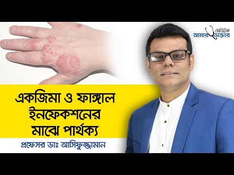 Eczema and fungal infection difference | Fungal infection of skin | Eczema skin care