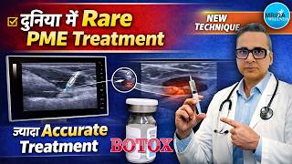 PME का असरदार इलाज | PME Treatment That Actually Works | Ultrasound Guided Botox Technique!