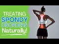How to Treat Spondy Disorders Naturally | The Stretch Mobility Coach Tips