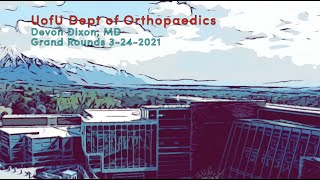 Flatfoot Deformities: Devon Nixon, MD - Foot/Ankle Core Curriculum.