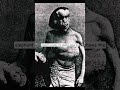 Joseph Merrick: The Elephant Man and His Extraordinary Life 🧠🕯️