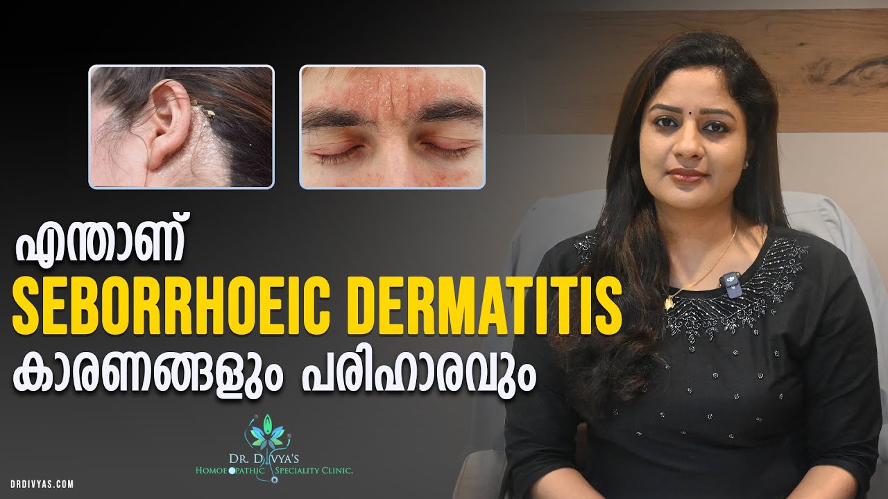 എന്താണ് Seborrhoeic Dermatitis - കാരണങ്ങളും പരിഹാരവും | Seborrhoeic Dermatitis - Causes & Treatment