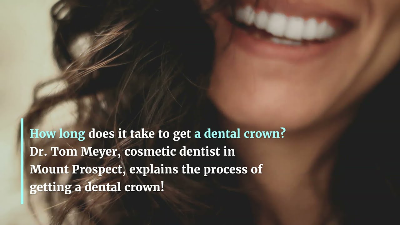 How long does it take to get a Dental Crown? Dental Clinic