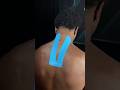 Taping For Neck Pain