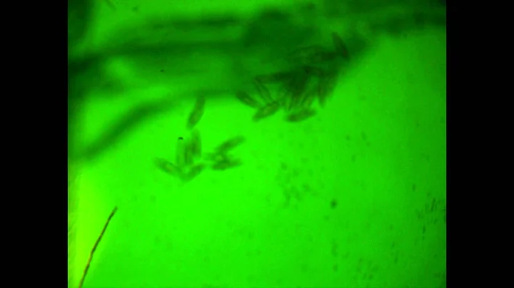 death of paramecium by infrared heating, Dr. Lev N...