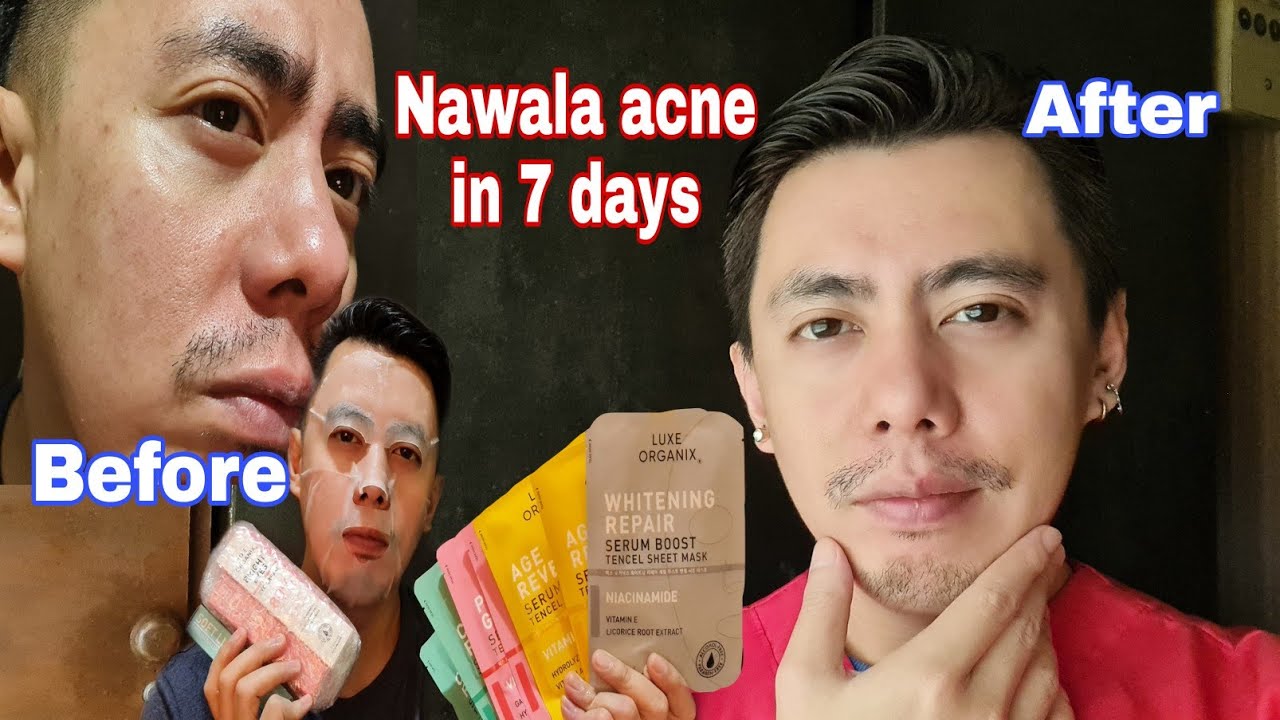 7 DAYS USE | LUXE ORGANIX TENCEL SHEET FACE MASK SERUM (WHITENING, ANTI AGING, VITAMIN E) REVIEW