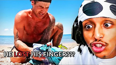 BRO GOT HIS FINGER BIT OFF BY A "DANGEROUS" PUFFER FISH...