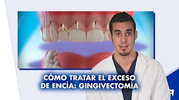 ¿Duele la cirugía de sonrisa gingival?