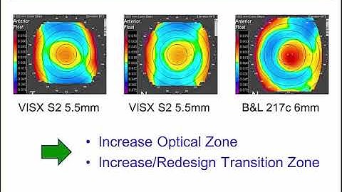 LASIK High Hyperopia - differences from myopia LASIK - and how it is possible to safely perform this