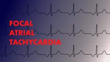 Focal Atrial Tachycardia - EKG Interpretation - MEDZCOOL