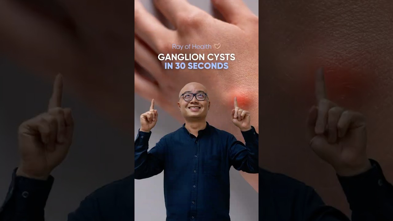Ganglion Cysts in 30 Seconds