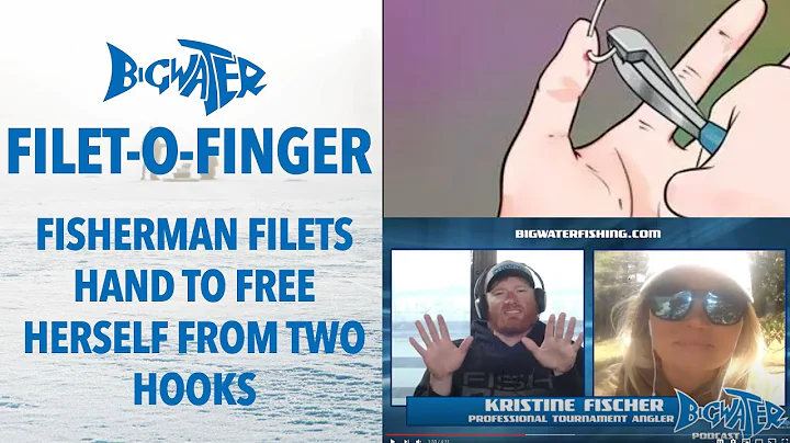 Filet O' Finger - Pro Fisherman Filets Her Hand to Free it From Fishing Hooks