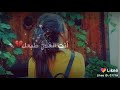 كلبي الوفي الحساس ممعلمه يجرح ناس كلبي الوفي الحساس ممعلمه يجرح ناس
