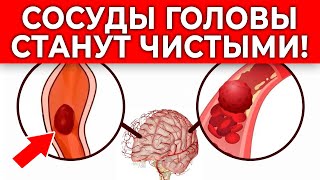 Пей ЭТО от головной боли! Сосуды головы станут ЧИСТЫМИ! | 3 способа очистить сосуды