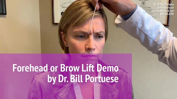 Forehead Lift - Browlift Surgery - 👨🏻‍⚕️ Seattle Facial Plastic Surgeon | ☎️ (206) 624-6200