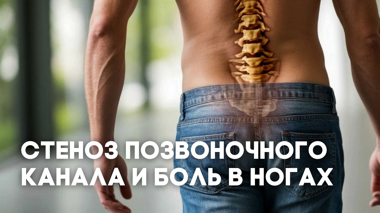 Стеноз позвоночного канала - почему его часто пропускают врачи?
