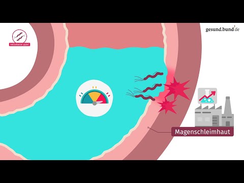 Video: Wo ist die präpylorische Region?