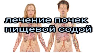 Лечение почек содой. Народная медицина. Эксперимент. Профессор. Доктор. Академик. Учёный. Лекарь.