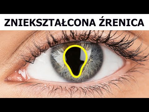 Ponad 20 najrzadszych