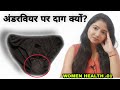 अंडरवियर पर दाग क्यों? Why do women's underwear get white stains?